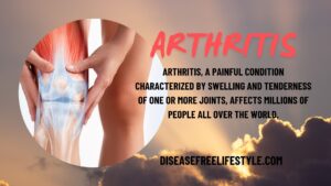 Arthritis